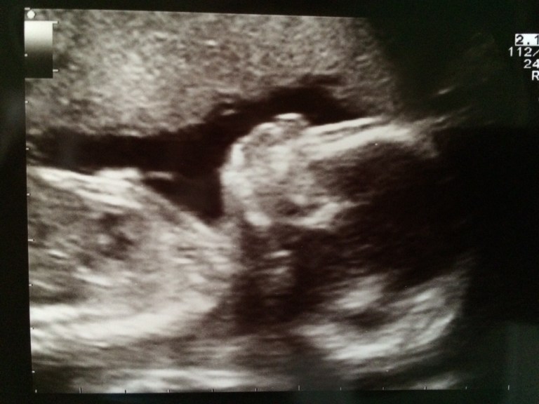 2015-11-17 21.44.32.jpg